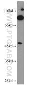 N-acetyllactosaminide beta-1,6-N-acetylglucosaminyl-transferase antibody, 18118-1-AP, Proteintech Group, Western Blot image 