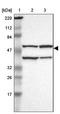 Haloacid Dehalogenase Like Hydrolase Domain Containing 5 antibody, PA5-52161, Invitrogen Antibodies, Western Blot image 