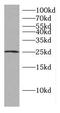 Coiled-Coil Domain Containing 25 antibody, FNab01351, FineTest, Western Blot image 