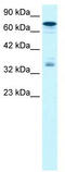 NFKB Inhibitor Beta antibody, TA335824, Origene, Western Blot image 
