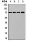 HSP70 antibody, orb256610, Biorbyt, Western Blot image 