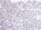 Homeobox-containing protein 1 antibody, LS-C185605, Lifespan Biosciences, Immunohistochemistry paraffin image 