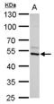 Arginine decarboxylase antibody, LS-B10875, Lifespan Biosciences, Western Blot image 