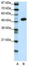 Transcriptional Adaptor 3 antibody, TA343602, Origene, Western Blot image 