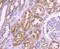 Y-Box Binding Protein 1 antibody, NBP2-67491, Novus Biologicals, Immunohistochemistry paraffin image 
