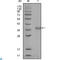 NCOR1 antibody, LS-C814060, Lifespan Biosciences, Immunohistochemistry paraffin image 