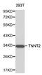 Troponin T2, Cardiac Type antibody, LS-C192235, Lifespan Biosciences, Western Blot image 