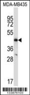 C-C Motif Chemokine Receptor 9 antibody, 57-310, ProSci, Western Blot image 