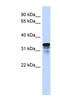Regulator of microtubule dynamics protein 1 antibody, NBP1-57839, Novus Biologicals, Western Blot image 