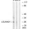 Low Density Lipoprotein Receptor Class A Domain Containing 1 antibody, A15115, Boster Biological Technology, Western Blot image 