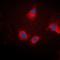 Apoptotic Chromatin Condensation Inducer 1 antibody, orb74393, Biorbyt, Immunofluorescence image 