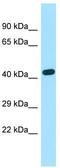 Exocyst Complex Component 3 Like 2 antibody, TA331251, Origene, Western Blot image 