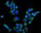 Sterol 26-hydroxylase, mitochondrial antibody, A02121-2, Boster Biological Technology, Immunofluorescence image 