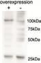 Alanyl-tRNA synthetase, mitochondrial antibody, TA311493, Origene, Western Blot image 
