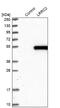 Leucine Rich Repeat Containing 2 antibody, NBP1-86250, Novus Biologicals, Western Blot image 