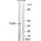 Protein Tob1 antibody, A04119, Boster Biological Technology, Western Blot image 