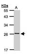 CKLF Like MARVEL Transmembrane Domain Containing 5 antibody, orb69843, Biorbyt, Western Blot image 