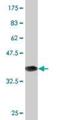 Cholinergic Receptor Nicotinic Beta 3 Subunit antibody, H00001142-M01, Novus Biologicals, Western Blot image 