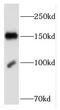 Fibronectin Type III Domain Containing 3B antibody, FNab03177, FineTest, Western Blot image 