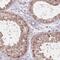 VPS52 Subunit Of GARP Complex antibody, NBP2-30721, Novus Biologicals, Immunohistochemistry frozen image 