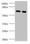 Phosphoglycerate Dehydrogenase antibody, A51657-100, Epigentek, Western Blot image 