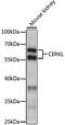 Ceramide Kinase Like antibody, 16-361, ProSci, Western Blot image 