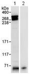 Chromodomain Helicase DNA Binding Protein 8 antibody, ab114126, Abcam, Immunoprecipitation image 