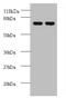 Casein Kinase 1 Epsilon antibody, A52740-100, Epigentek, Western Blot image 