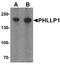 PH Domain And Leucine Rich Repeat Protein Phosphatase 1 antibody, A02430-2, Boster Biological Technology, Western Blot image 