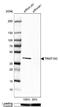 TRNA Methyltransferase 10C, Mitochondrial RNase P Subunit antibody, NBP1-83654, Novus Biologicals, Western Blot image 