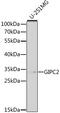 GIPC PDZ Domain Containing Family Member 2 antibody, 14-333, ProSci, Western Blot image 
