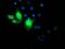 NADH-cytochrome b5 reductase 3 antibody, MA5-25143, Invitrogen Antibodies, Immunocytochemistry image 
