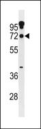 Zinc Finger Protein 805 antibody, PA5-72127, Invitrogen Antibodies, Western Blot image 