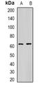 Carboxylesterase 1 antibody, orb340788, Biorbyt, Western Blot image 