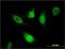 Splicing Regulatory Glutamic Acid And Lysine Rich Protein 1 antibody, H00140890-M01, Novus Biologicals, Immunocytochemistry image 