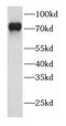 Protein DBF4 homolog A antibody, FNab02255, FineTest, Western Blot image 