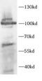 REP1 antibody, FNab10380, FineTest, Western Blot image 