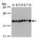 Eukaryotic Translation Initiation Factor 5A2 antibody, PA5-22118, Invitrogen Antibodies, Western Blot image 