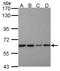 Proteasome 26S Subunit, Non-ATPase 3 antibody, PA5-27665, Invitrogen Antibodies, Western Blot image 