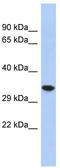 Cellular Repressor Of E1A Stimulated Genes 2 antibody, TA337812, Origene, Western Blot image 