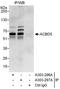 Acyl-CoA Binding Domain Containing 5 antibody, A303-297A, Bethyl Labs, Immunoprecipitation image 