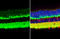 Vesicle Associated Membrane Protein 2 antibody, GTX634812, GeneTex, Immunohistochemistry paraffin image 