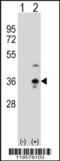 Collectin-11 antibody, 62-494, ProSci, Western Blot image 