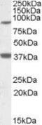 Ceramide Synthase 1 antibody, GTX88587, GeneTex, Western Blot image 