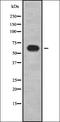 Pantothenate kinase 2, mitochondrial antibody, orb337384, Biorbyt, Western Blot image 