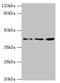 MHC Class I Polypeptide-Related Sequence A antibody, orb352681, Biorbyt, Western Blot image 
