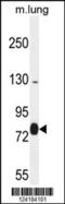 Exocyst Complex Component 8 antibody, 55-084, ProSci, Western Blot image 