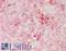 Dihydrofolate Reductase antibody, LS-B14863, Lifespan Biosciences, Immunohistochemistry paraffin image 