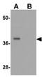Prickle Planar Cell Polarity Protein 4 antibody, GTX32042, GeneTex, Western Blot image 