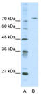 Afamin antibody, TA334277, Origene, Western Blot image 
